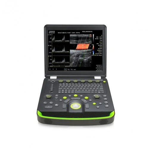 Аппарат УЗИ ELS-500-T-CS