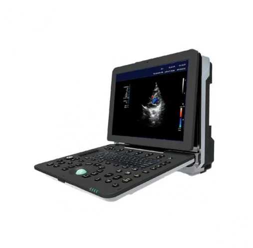 Аппарат УЗИ ELS-500-T-Lite