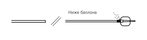 Баллоны для литоэкстракции Extractor" Pro RX