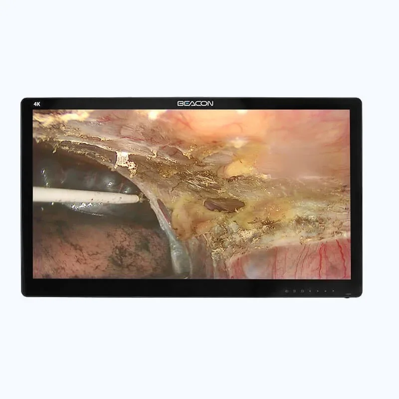 Медицинский монитор Beacon 32 4K