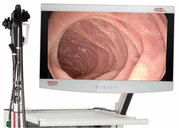 Медицинский монитор NDS Radiance 27 Ultra